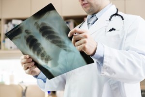 Doctor reviewing radiograph from accident